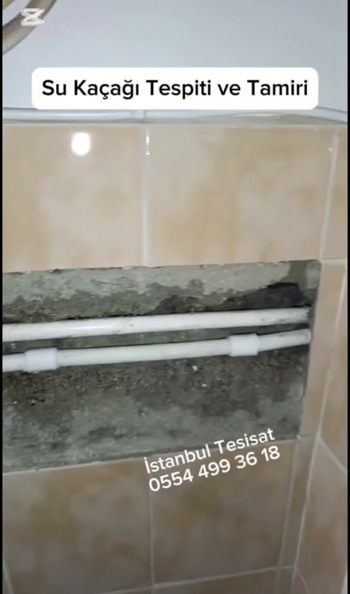 Güngören Kameralı Pimaş Görüntüleme